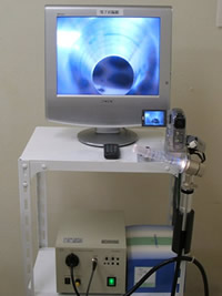 直腸電子内視鏡